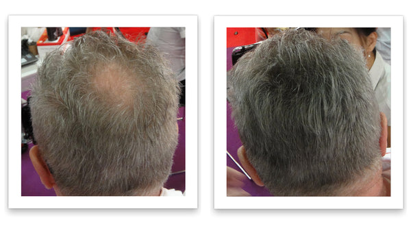 Before and after image of a man with short gray hair and a bald spot on his crown