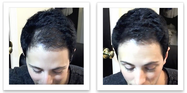 Person with short wavy black hair and has thin hair on the left side of their frontal scalp
