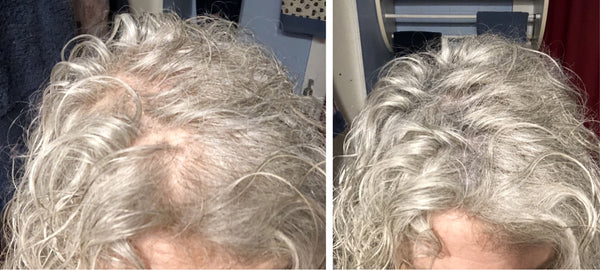 Before and after image of a person with short curly gray hair and thin hair on their parting line