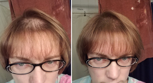 Before and after image of a person with short brown hair and a bald spot on their crown