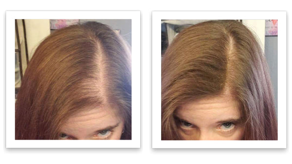Before and after image of a woman with long straight light brown hair with thin hair on her parting line